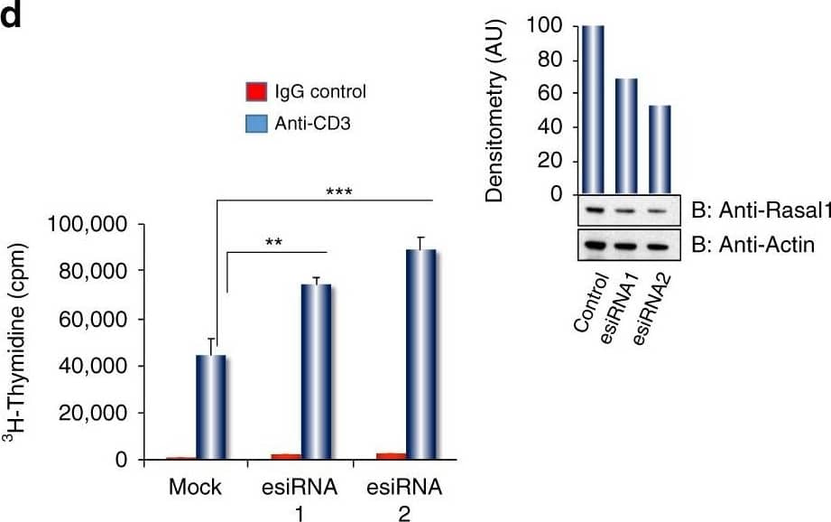 Western Blot: RASAL1 Antibody [NBP1-32776] - Rasal1 inhibits in vitro anti-CD3 & dendritic cell-peptide induced T-cell activation. a Antigen (OVA323-39)-dependent activation & proliferation of DO11.10 CD4 + cells expressing Flag-tagged Rasal1 compared with control cells at different OVA peptide concentrations (5–10 ng). CTLA-Ig was used as a control. Upper inset shows expression of Flag-tagged Rasal using anti-Flag in blotting (n = 3). b Inhibition of T-cell responses by Rasal1 to increasing anti-CD3 concentrations. Upper inset: effects of Rasal1 at 48 & 72 h post-anti-CD3 activation (n = 3). c Anti-CD3-driven NFATc1/AP1 promoter activity in Jurkat T cells was inhibited by the presence of Flag-tagged Rasal1 (n = 3). d siRNA (esiRNA) knockdown of Rasal1 enhances T-cell proliferation. esiRNA were tested for their knockdown efficiency by western blot (top right panel), esiRNA1 & 2 correspond to 500 nM & 1000 nM concentrations (n = 3). e Contact time between D011.10 CD4+T-cells expressing Flag-Rasal1 (red) or empty vector (blue) & OVA peptide on bone marrow dendritic cells (BMDCs). Dot blot of T cell/DC contact duration time in presence of OVA was unaffected by Flag-tagged Rasal1 or vector transfection (n = 3). Representative plots show mean with ± SD. p-value was calculated by unpaired t test. *p < 0.05, **p < 0.01, ***p < 0.001 Image collected & cropped by CiteAb from the following publication (//pubmed.ncbi.nlm.nih.gov/31641113), licensed under a CC-BY license. Not internally tested by Novus Biologicals.