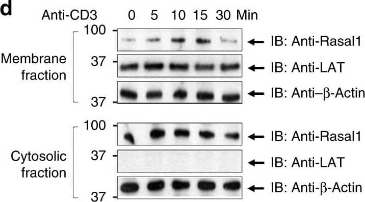 Western Blot: RASAL1 Antibody [NBP1-32776] - TCR complex purification & Rasal1 association with ZAP-70 in the TCR complex. a Analytic gel from tandem affinity purification (TAP) of TCR plus associated proteins captured from TCR-constituted cells (TCR complex) versus TCR-null negative control cells (control) (left panel). Chart showing the list of TCR-associated proteins identified by MS analysis (right upper panel). The structure of Rasal1 (right lower panel). b Co-precipitation of ZAP-70 with TCR from 3A9 T cells. 3A9 cells were stimulated for 10 min with anti-CD3 followed by immunoprecipitation with anti-TCR zeta & blotting with anti-ZAP-70 or anti-zeta. Lane 1: resting T cells; lane 2: anti-CD3-stimulated T cells. c Rasal1 expression is induced with anti-CD3 activation. Relative fold change expression of Rasal1 versus Rasal3 upon anti-CD3 stimulation of CD4+ & CD8 + peripheral T cells. 18 s rRNA served as a control. d Anti-CD3 induces Rasal1 translocation to the membranes of T cells. Stimulation-dependent association of Rasal1 with the membrane (upper panel) versus cytosolic Rasal1 (lower panel). Anti-actin served as a loading control. LAT was used as a marker of membrane enrichment fractionation (n = 3) Image collected & cropped by CiteAb from the following publication (//pubmed.ncbi.nlm.nih.gov/31641113), licensed under a CC-BY license. Not internally tested by Novus Biologicals.