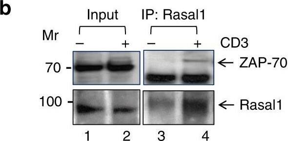 Western Blot: RASAL1 Antibody [NBP1-32776] - Rasal1 binds to the immune cell tyrosine kinase ZAP-70. a Proximity ligation assay (PLA) of Rasal1 & ZAP-70 in Jurkat T-cells stained with DAPI, anti-Rasal1, & anti-ZAP-70. Positive PLA signal (fluorescent dots) indicates a distance of 30–40 nm between Rasal1 & ZAP-70 in anti-CD3-activated T cells, indicating their close proximity (n = 2). b Anti-Rasal1 co-precipitates ZAP-70 from primary mouse T cells. Lane 1–2 loading controls, lanes 3-4: anti-Rasal1 IP: lanes 2 & 4. Cells were stimulated with anti-CD3 ligation for 5 min vs IgG control ligation in lanes 1 & 3. c Anti-Rasal1 co-precipitates ZAP-70 from transfected Jurkat T cells. Lanes 1: nonligated (i.e., IgG); lane 2: anti-CD3 ligated T cells for 5 min. Lower panel shows similar level of ZAP-70 expression in lysates of (n = 2) Image collected & cropped by CiteAb from the following publication (//pubmed.ncbi.nlm.nih.gov/31641113), licensed under a CC-BY license. Not internally tested by Novus Biologicals.