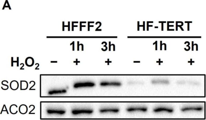 Western Blot Aconitase 2 Antibody - BSA Free