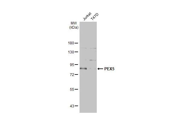 Western Blot: PEX5 Antibody [NBP1-32782] - Various whole cell extracts (30 ug) were separated by 7.5% SDS-PAGE, and the membrane was blotted with PEX5 antibody (NBP1-32782) diluted at 1:5000. The HRP-conjugated anti-rabbit IgG antibody  was used to detect the primary antibody.