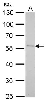 Western Blot: Pancreatic Lipase Antibody [NBP1-32789] - Pancreatic Lipase antibody [N1C1] detects PNLIP protein by Western blot analysis.A. 30 ug 293T whole cell lysate/extract10 % SDS-PAGEPancreatic Lipase antibody [N1C1] (NBP1-32789) dilution: 1:1000