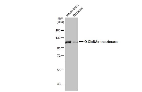 Western Blot: O-GlcNAc Transferase p110 subunit Antibody [NBP1-32791] - Various tissue extracts (50 ug) were separated by 7.5% SDS-PAGE, and the membrane was blotted with O-GlcNAc Transferase p110 subunit antibody (NBP1-32791) diluted at 1:5000. The HRP-conjugated anti-rabbit IgG antibody  was used to detect the primary antibody.