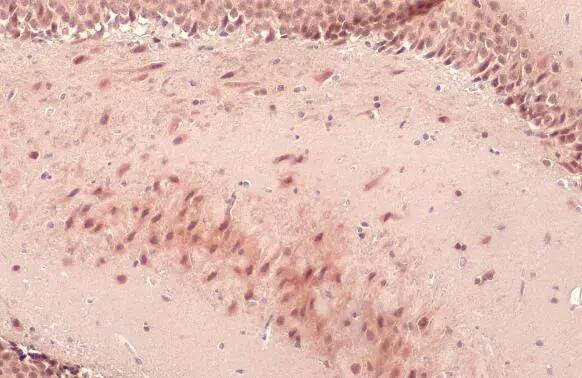 Immunohistochemistry-Paraffin: O-GlcNAc Transferase p110 subunit Antibody [NBP1-32791] - O-GlcNAc Transferase p110 subunit antibody detects O-GlcNAc Transferase p110 subunit protein at cytoplasm and nucleus by immunohistochemical analysis.Sample: Paraffin-embedded rat brain.O-GlcNAc Transferase p110 subunit stained by O-GlcNAc Transferase p110 subunit antibody (NBP1-32791) diluted at 1:500.Antigen Retrieval: Citrate buffer, pH 6.0, 15 min