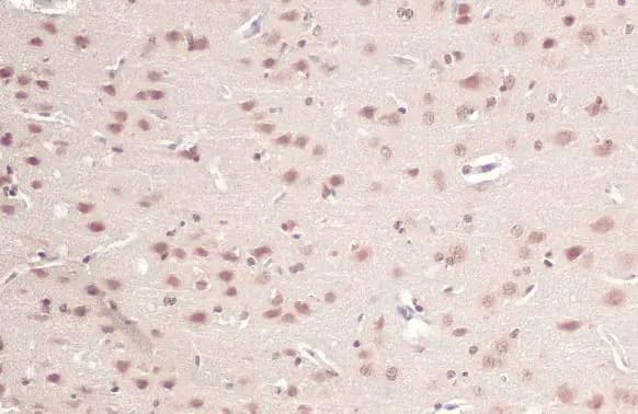 Immunohistochemistry-Paraffin: O-GlcNAc Transferase p110 subunit Antibody [NBP1-32791] - O-GlcNAc Transferase p110 subunit antibody detects O-GlcNAc Transferase p110 subunit protein at cytoplasm and nucleus by immunohistochemical analysis.Sample: Paraffin-embedded rat brain.O-GlcNAc Transferase p110 subunit stained by O-GlcNAc Transferase p110 subunit antibody (NBP1-32791) diluted at 1:500.Antigen Retrieval: Citrate buffer, pH 6.0, 15 min