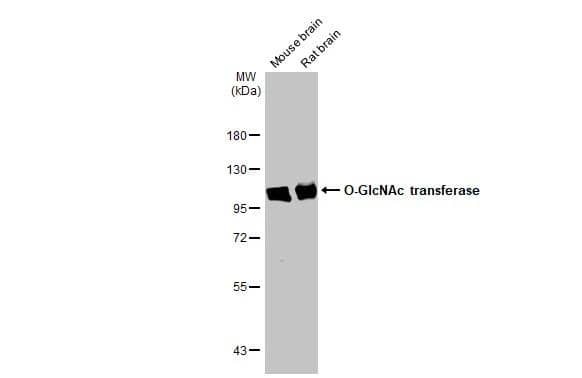 Various tissue extracts (50 ug) were separated by 7.5% SDS-PAGE, and the membrane was blotted with O-GlcNAc Transferase p110 subunit antibody (NBP1-32791) diluted at 1:5000. The HRP-conjugated anti-rabbit IgG antibody was used to detect the primary antibody. 