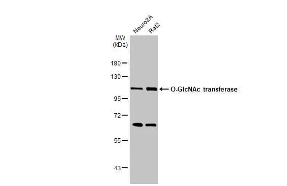 Various whole cell extracts (30 ug) were separated by 7.5% SDS-PAGE, and the membrane was blotted with O-GlcNAc transferase antibody (NBP1-32791) diluted at 1:5000. The HRP-conjugated anti-rabbit IgG antibody  was used to detect the primary antibody. 