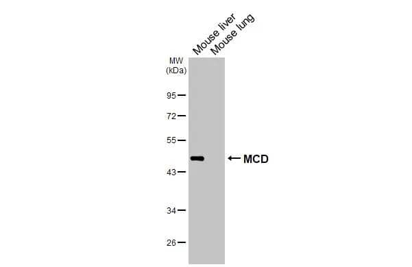 Various tissue extracts (50 ug) were separated by 10% SDS-PAGE, and the membrane was blotted with MCD antibody [N2C1], Internal (NBP1-32797) diluted at 1:500. The HRP-conjugated anti-rabbit IgG antibody  was used to detect the primary antibody. 