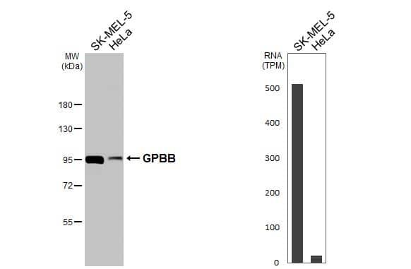 Various whole cell extracts (30 ug) were separated by 7.5% SDS-PAGE, and the membrane was blotted with Glycogen Phosphorylase BB/GPBB antibody (NBP1-32799) diluted at 1:1000. The HRP-conjugated anti-rabbit IgG antibody was used to detect the primary antibody. Corresponding RNA expression data for the same cell lines are based on Human Protein Atlas program. 