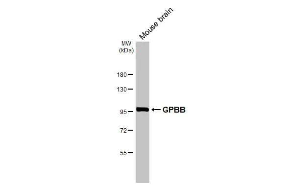 Western Blot Glycogen Phosphorylase BB/GPBB Antibody