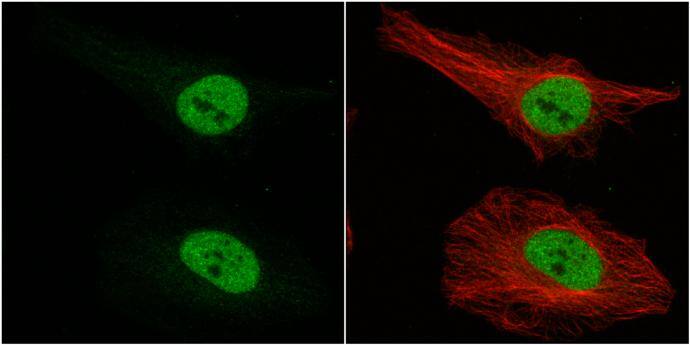 MSI1 antibody [N3C3] detects MSI1 protein at nucleus by immunofluorescent analysis.Sample: HeLa cells were fixed in 4% paraformaldehyde at RT for 15 min.Green: MSI1 protein stained by MSI1 antibody [N3C3] (NBP1-32812) diluted at 1:500.Red: alpha Tubulin, a cytoskeleton marker, stained by alpha Tubulin antibody [GT114]  diluted at 1:1000. 