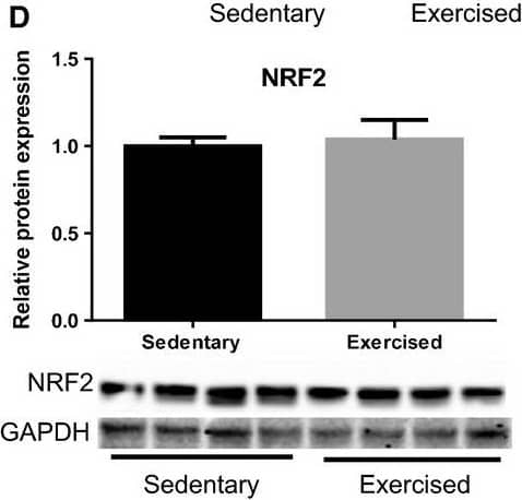 Western Blot Nrf2 Antibody - BSA Free