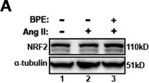 Western Blot: Nrf2 Antibody [NBP1-32822] - Blueberry polyphenol extract (BPE) increases the expression of NRF2 & HO-1 while reducing NF-kappa B p65 phosphorylation in angiotensin (Ang) II-treated human aortic endothelial cells (HAECs). HAECs were treated with 200 µg/mL of BPE for 1 h then treated with 200 nM of Ang II for 12 h. Protein expression of NRF2 (A,B), HO-1 (C,D), & NF-kappa B p65 (E,F) were determined by Western blot. Quantification was performed using Image Lab (Bio-Rad Laboratories, Inc.). Data are expressed as mean ± SD from nine (HO-1), & three (NRF2 & NF-kappa B) independent experiments. Values that do not share the same letter are significantly different from each other (p ≤ 0.05). Image collected & cropped by CiteAb from the following publication (//pubmed.ncbi.nlm.nih.gov/35453301), licensed under a CC-BY license. Not internally tested by Novus Biologicals.