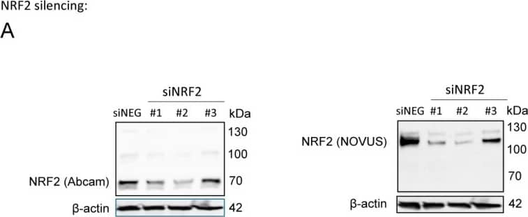 Western Blot: Nrf2 Antibody [NBP1-32822] - NRF2 antibody validation. (A) NRF2 expression was silenced in MCF7 cells by transiently transfecting NRF2-specific siRNAs or a negative control siRNA for 48 h, then NRF2 protein expression was determined using two different antibodies (Abcam: ab31163; NOVUS: NBP1-32822). (B–D) 4T1 cells were treated with NRF2 activators, RA839 or tBHQ, or MG-132, a proteasome inhibitor, in the concentrations indicated for 48 h, then NRF2 protein expression was determined by western blotting using two different antibodies (Abcam: ab31163; NOVUS: NBP1-32822). Image collected & cropped by CiteAb from the following publication (//pubmed.ncbi.nlm.nih.gov/31461945), licensed under a CC-BY license. Not internally tested by Novus Biologicals.