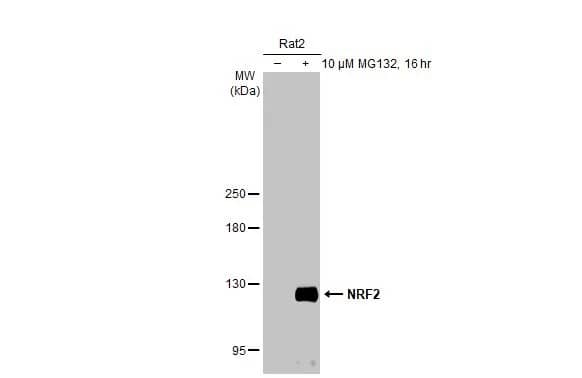 Western Blot: Nrf2 Antibody [NBP1-32822] - Untreated (-) and treated (+) Rat2 whole cell extracts (30 ug) were separated by 5% SDS-PAGE, and the membrane was blotted with Nrf2 antibody [N2C2], Internal (NBP1-32822) diluted at 1:2000. The HRP-conjugated anti-rabbit IgG antibody  was used to detect the primary antibody, and the signal was developed with Trident ECL plus-Enhanced.