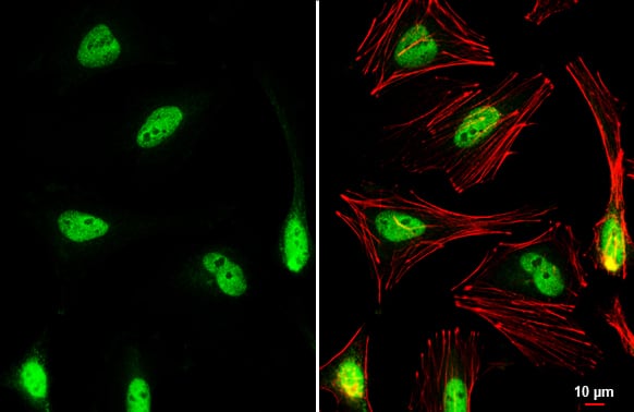 Immunocytochemistry/ Immunofluorescence: Nrf2 Antibody [NBP1-32822] - Nrf2 antibody [N2C2], Internal detects Nrf2 protein at nucleus by immunofluorescent analysis.Sample: HeLa cells were fixed in 4% paraformaldehyde at RT for 15 min.Green: Nrf2 stained by Nrf2 antibody [N2C2], Internal (NBP1-32822) diluted at 1:1000.Red: phalloidin, a cytoskeleton marker, diluted at 1:200.Scale bar= 10 um.