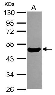 Western Blot: Cytokeratin 17 Antibody [NBP1-32824] - Sample (30 ug of whole cell lysate)  A: HeLa  10% SDS PAGE  NBP1-32824 diluted at 1:5000 