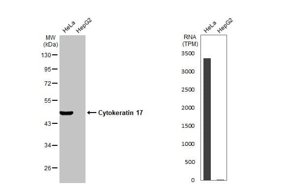 <b>Orthogonal Strategies Validation. </b>Various whole cell extracts (30 ug) were separated by 10% SDS-PAGE, and the membrane was blotted with Cytokeratin 17 (NBP1-32824) diluted at 1:5000. The HRP-conjugated anti-rabbit IgG antibody was used to detect the primary antibody. Corresponding RNA expression data for the same cell lines are based on Human Protein Atlas program. 