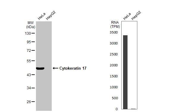 Various whole cell extracts (30 ug) were separated by 10% SDS-PAGE, and the membrane was blotted with Cytokeratin 17 (NBP1-32824) diluted at 1:5000. The HRP-conjugated anti-rabbit IgG antibody  was used to detect the primary antibody. Corresponding RNA expression data for the same cell lines are based on Human Protein Atlas program. 