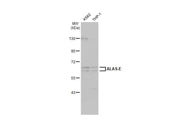 Various whole cell extracts (30 ug) were separated by 7.5% SDS-PAGE, and the membrane was blotted with ALAS-E antibody [N3C3]  (NBP1-32826) diluted at 1:500. The HRP-conjugated anti-rabbit IgG antibody  was used to detect the primary antibody. 