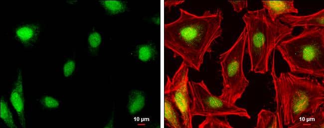 DAX1/NR0B1 antibody detects DAX1/NR0B1 protein at nucleus by immunofluorescent analysis.Sample: HeLa cells were fixed in 4% paraformaldehyde at RT for 15 min.Green: DAX1/NR0B1 protein stained by DAX1/NR0B1 antibody (NBP1-32832) diluted at 1:200.Red: phalloidin, a cytoskeleton marker, diluted at 1:200.Scale bar = 10 um. 