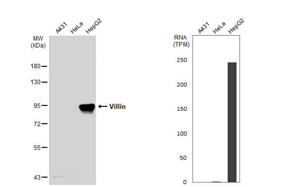 <b>Orthogonal Strategies Validation. </b>Western Blot: Villin 1 Antibody [NBP1-32841] - Various whole cell extracts (30 ug) were separated by 7.5% SDS-PAGE, and the membrane was blotted with Villin antibody  diluted at 1:2000. The HRP-conjugated anti-rabbit IgG antibody  was used to detect the primary antibody. Corresponding RNA expression data for the same cell lines are based on Human Protein Atlas program.