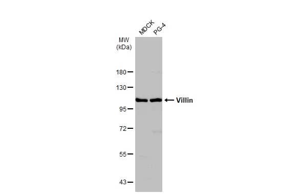 Western Blot: Villin 1 Antibody [NBP1-32841] - Various whole cell extracts (30 ug) were separated by 7.5% SDS-PAGE, and the membrane was blotted with Villin 1 antibody (NBP1-32841) diluted at 1:500. The HRP-conjugated anti-rabbit IgG antibody  was used to detect the primary antibody.