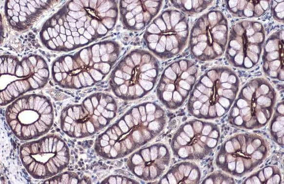 Immunohistochemistry-Paraffin: Villin 1 Antibody [NBP1-32841] - Villin 1 antibody detects VIL1 protein at cell membrane by immunohistochemical analysis.Sample: Paraffin-embedded dog colon.VIL1 stained by Villin 1 antibody (NBP1-32841) diluted at 1:500.Antigen Retrieval: Citrate buffer, pH 6.0, 15 min