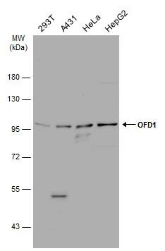 Western Blot: OFD1 Antibody [NBP1-32843] - Various whole cell extracts (30 ug) were separated by 7.5% SDS-PAGE, and the membrane was blotted with OFD1 antibody (NBP1-32843) diluted at 1:1000. The HRP-conjugated anti-rabbit IgG antibody  was used to detect the primary antibody.