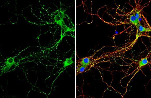 Rab3C antibody [N1C3] detects Rab3C protein by immunofluorescent analysis.Sample: DIV9 rat E18 primary hippocampal neuron cells were fixed in 4% paraformaldehyde at RT for 15 min.Green: Rab3C stained by Rab3C antibody [N1C3] (NBP1-32871) diluted at 1:500.Red: beta Tubulin 3/ Tuj1, stained by beta Tubulin 3/ Tuj1 antibody [GT11710] diluted at 1:500.Blue: Fluoroshield with DAPI . 