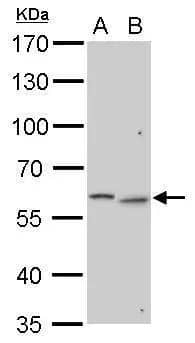 N-Acetylgalactosamine-6-Sulfatase/GALNS antibody detects N-Acetylgalactosamine-6-Sulfatase/GALNS protein by western blot analysis.A. 30 ug Neuro2A whole cell lysate/extract B. 30 ug C2C12 whole cell lysate/extract 7.5% SDS-PAGEN-Acetylgalactosamine-6-Sulfatase/GALNS antibody (NBP1-32899) dilution: 1:1000 The HRP-conjugated anti-rabbit IgG antibody was used to detect the primary antibody. 