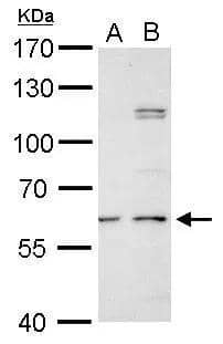 N-Acetylgalactosamine-6-Sulfatase/GALNS antibody detects N-Acetylgalactosamine-6-Sulfatase/GALNS protein by western blot analysis.A. 30 ug PC-12 whole cell lysate/extract B. 30 ug Rat2 whole cell lysate/extract7.5% SDS-PAGEN-Acetylgalactosamine-6-Sulfatase/GALNS antibody (NBP1-32899) dilution: 1:500 The HRP-conjugated anti-rabbit IgG antibody was used to detect the primary antibody. 