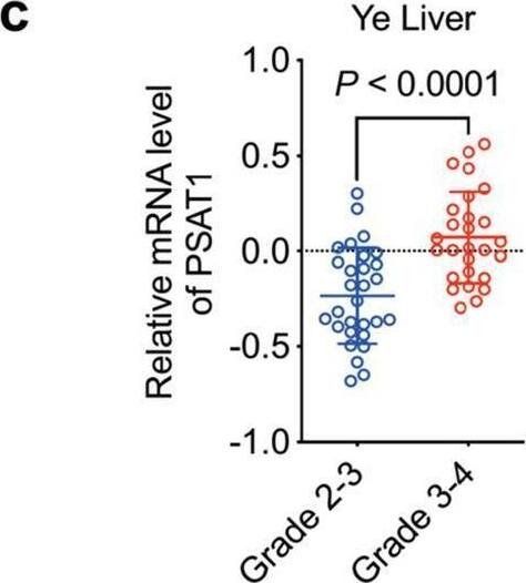 PSAT1 is up-regulated in human metastatic HCC tissues and predicts poor prognosis. a, b Kaplan-Meier analysis of overall survival rate based on PSAT1 expression in HCC samples and TCGA-Liver dataset. c PSAT1 mRNA levels in different grades of HCC patients according to Oncomine data set Ye Liver. d PSAT1 mRNA levels in HCC patients with or without vascular invasion according to Oncomine dataset Wurmbach Liver. e PSAT1 mRNA levels in primary or metastatic tumor tissues according to Oncomine dataset Ye Liver. f PSAT1 mRNA levels in HCC tissues with or without metastases according to Oncomine dataset Ye Liver. g IHC analysis of PSAT1 protein level in HCC tissue samples with (n = 26) or without (n = 46) intrahepatic metastasis. Scale bar, 20 μm. Data are means +/- s.d. ***P < 0.001. h HE and IHC analysis of PSAT1 protein level in mice liver and lung (intrahepatical mice model). Scale bar, 1000 μm. Data are means +/- s.d. ***P < 0.001 Image collected and cropped by CiteAb from the following open publication (//pubmed.ncbi.nlm.nih.gov/36788227), licensed under a CC-BY license. Not internally tested by Novus Biologicals.