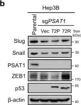 Loss of PSAT1 inhibits the metastatic potential of HCC cells containing p5372P. a Transwell assay showing the migration and invasion of parental Hep3B cells or PSAT1 knockout Hep3B cells transfected with vector, p53-72P, and p53-72R plasmids. Scale bar, 100 μm. b Immunoblotting analysis of indicated proteins in parental or PSAT1 knockout Hep3B cells transfected with vector, p53-72P, and p53-72R plasmids. c Transwell assay showing the migration and invasion of parental or PSAT1 knockout PLC/PRF/5 cells. Scale bar, 50 μm. d Wound healing assay showing cell migration of parental or PSAT1 knockout PLC/PRF/5 cells after 24 h. Scale bar, 200 μm. e Parental or PSAT1 knockout PLC/PRF/5 cells were intrahepatically injected into BALB/c nude mice and the lung metastases were then calculated. Scale bar, 200 μm. f Cell viability of parental or PSAT1 knockout PLC/PRF/5 cells treated with glucose restriction for 4 days. g Survival fraction of parental or PSAT1 knockout PLC/PRF/5 cells treated with or without 2.5 mM 2-DG. h Statistic dead cells of PLC/PRF/5 cells measured by Trypan blue staining. Parental or PSAT1 knockout PLC/PRF/5 cells were treated with or without poly-HEMA for 6 h. i Immunoblotting analysis of PSAT1 and  beta -actin in PLC/PRF/5 and Huh7 cells treated with or without glucose restriction for 24 h. j Immunoblotting analysis of PSAT1 and  beta -actin in indicated cells treated with or without poly-HEMA for 6 h. Data are means +/- s.d. NS not significant, **P < 0.01, ***P < 0.001 Image collected and cropped by CiteAb from the following open publication (//pubmed.ncbi.nlm.nih.gov/36788227), licensed under a CC-BY license. Not internally tested by Novus Biologicals.