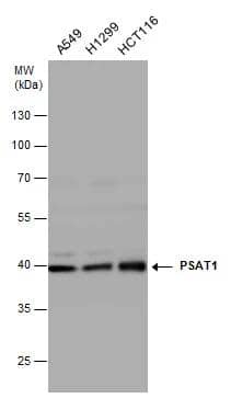 PSAT1 antibody [N1C3] detects PSAT1 protein by Western blot analysis. Various whole cell extracts (30 ug) were separated by 10% SDS-PAGE, and the membrane was blotted with PSAT1 antibody [N1C3] (NBP1-32920) diluted at 1:1000. 