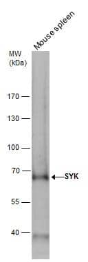 SYK antibody detects SYK protein by western blot analysis. Mouse tissue extracts (50 ug) was separated by 7.5% SDS-PAGE, and the membrane was blotted with SYK antibody (NBP1-32945) diluted by 1:1000. The HRP-conjugated anti-rabbit IgG antibody was used to detect the primary antibody. 