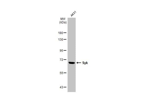 Whole cell extract (30 ug) was separated by 7.5% SDS-PAGE, and the membrane was blotted with SYK antibody [N2C2], Internal (NBP1-32945) diluted at 1:1000. The HRP-conjugated anti-rabbit IgG antibody was used to detect the primary antibody. 