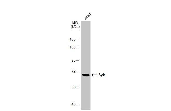 Whole cell extract (30 ug) was separated by 7.5% SDS-PAGE, and the membrane was blotted with Syk antibody [N2C2], Internal (NBP1-32945) diluted at 1:1000. The HRP-conjugated anti-rabbit IgG antibody  was used to detect the primary antibody. 