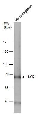 SYK antibody detects SYK protein by western blot analysis. Mouse tissue extracts (50 ug) was separated by 7.5% SDS-PAGE, and the membrane was blotted with SYK antibody (NBP1-32945) diluted by 1:1000. The HRP-conjugated anti-rabbit IgG antibody  was used to detect the primary antibody. 