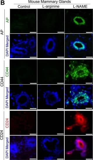 Deprivation of NO induces bi-lineage phenotype and expression of stem cell markers in mammary epithelial cells both in vivo and in 3D cultures. (A) CK14 (basal) and CK8/18 (luminal) staining of mouse mammary glands treated with control (PBS), L-arginine or L-NAME for 6 weeks. Co-localization of CK14 and CK8/18 was captured with ImageJ. Scale bars: 100 μm. (See the quantification in Supplementary Fig. 6A). (B) Representative images of drug-treated mammary glands stained for stem cell markers: alkaline phosphatase (AP) (top 2 rows), CD44 (middle 2 rows) or CD24 (bottom 2 rows). Nuclei were counterstained with DAPI (blue). Scale bars: 50 μm. (See the quantification in Supplementary Fig. 6B–D). (C) CK14 and CK8/18 staining of non-malignant MCF10A cells cultivated in 3D ECM in the presence of control (PBS), L-arginine or L-NAME for 3 weeks. Scale bars: 50 μm. (See the quantification in Supplementary Fig. 6E). (D) Drug-treated MCF10A cells in 3D cultures stained for AP (top 2 rows), CD44 (middle 2 rows) or CD24 (bottom 2 rows). Nuclei were counterstained with DAPI (blue). Scale bars: 50 μm. (See the quantification in Supplementary Fig. 6F–H). Image collected and cropped by CiteAb from the following open publication (//pubmed.ncbi.nlm.nih.gov/31040372), licensed under a CC-BY license. Not internally tested by Novus Biologicals.