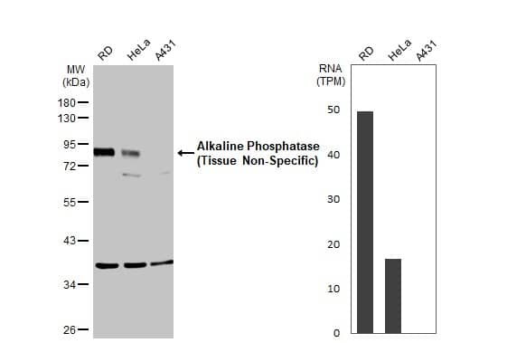 <b>Orthogonal Strategies Validation. </b>Various whole cell extracts (30 �g) were separated by 10% SDS-PAGE, and the membrane was blotted with Alkaline Phosphatase, Tissue Non-Specific antibody (NBP1-32948) diluted at 1:1000. The HRP-conjugated anti-rabbit IgG antibody was used to detect the primary antibody. Corresponding RNA expression data for the same cell lines are based on Human Protein Atlas program. 