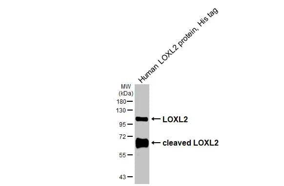 Human LOXL2 protein, His tag (0.05 ug) was separated by 10% SDS-PAGE, and the membrane was blotted with LOXL2 antibody (NBP1-32954) diluted at 1:5000. The HRP-conjugated anti-rabbit IgG antibody  was used to detect the primary antibody. 