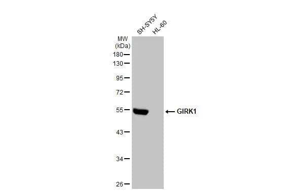 Western Blot Kir3.1 Antibody - BSA Free