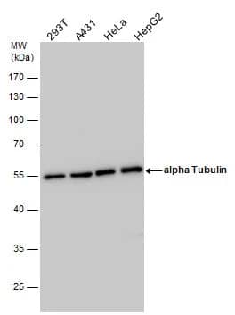 Western Blot: Tubulin alpha-1B Antibody [NBP1-32959] - Tubulin alpha-1B antibody detects Tubulin alpha-1B protein by western blot analysis. Various whole cell extracts (30 ug) were separated by 10% SDS-PAGE, and the membrane was blotted with Tubulin alpha-1B antibody (NBP1-32959) diluted by 1:1000. The HRP-conjugated anti-rabbit IgG antibody  was used to detect the primary antibody.