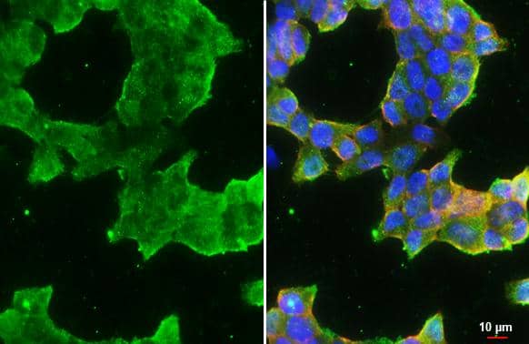Immunocytochemistry/ Immunofluorescence ATP6V1H Antibody - BSA Free