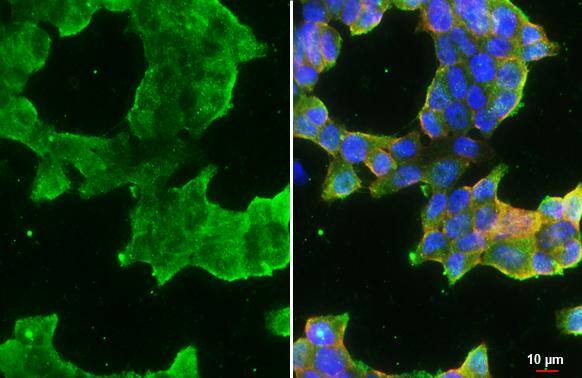 Immunocytochemistry/ Immunofluorescence ATP6V1H Antibody - BSA Free