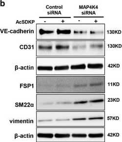 MAP4K4 deficiency induces TGF beta /smad signaling and EndMT via activation of integrin  beta 1. (a) HMVECs were transfected with MAP4K4 siRNA (100 nM) for 48 h. Next, the cells were treated with or without AcSDKP for 2 h. The p-smad3/smad3 pathway was analyzed by western blot. Densitometric analysis of the p-smad3/smad3 levels was performed, with n=3 for each group. (b) HMVECs were treated with MAP4K4 siRNA for 48 h with or without AcSDKP treatment. The VE-cadherin, CD31, FSP1, SM22 alpha  and vimentin protein levels were analyzed by western blot. (c) HMVECs were transfected with MAP4K4 siRNA for 48 h in the presence or absence of TGF beta 2 with or without AcSDKP. The integrin  beta 1 level was analyzed by western blot Image collected and cropped by CiteAb from the following open publication (//pubmed.ncbi.nlm.nih.gov/28771231), licensed under a CC-BY license. Not internally tested by Novus Biologicals.