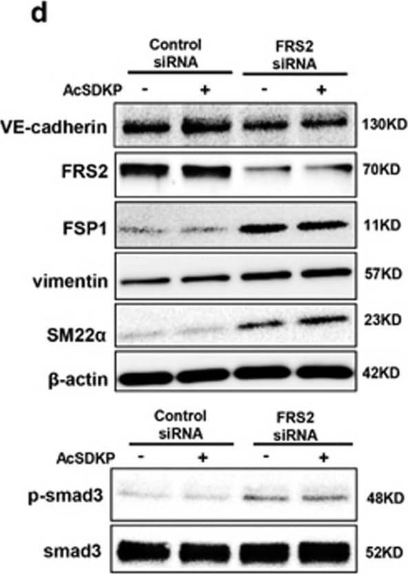 AcSDKP suppresses TGF beta /smad signaling and EndMT through the FGFR1/FRS2 pathway. (a) HMVECs were treated with N-FGFR1 for 48 h, and the FGFR1, TGF beta R1 and TGF beta R2 protein levels were analyzed by western blot. (b) HMVECs were treated with TGF beta 2 in the presence or absence of N-FGFR1 for 15 min with or without AcSDKP preincubation. The p-smad3 and TGF beta R1 protein levels were analyzed by western blot. Densitometric analysis of the p-smad3/smad3 and TGF beta R1/ beta -actin levels (n=3) in each group was performed. (c) HMVECs were incubated with either N-FGFR1 in the presence or absence of TGF beta 2 for 48 h with or without preincubation with AcSDKP for 2 h or with N-FGFR1 in the presence or absence of TGF beta 2 for 48 h with or without 24 h of incubation with FGF2 (50 ng/ml). The CD31, SM22 alpha , FSP1 and  alpha -SMA protein levels were analyzed by western blot. (d) HMVECs were transfected with FRS2 siRNA (100 nM) for 48 h with or without AcSDKP preincubation. The VE-cadherin, FSP1, vimentin, SM22 alpha  and p-smad3 levels were analyzed by western blot. (e) HMVECs were treated with N-FGFR1 for 48 h or 15 min in the presence or absence of N-TGF beta  (1, 2, 3) (1.0  μg/ml). The CD31, VE-cadherin, SM22 alpha , FSP1, TGF beta R1, TGF beta R2 and p-smad3 levels were analyzed by western blot Image collected and cropped by CiteAb from the following open publication (//pubmed.ncbi.nlm.nih.gov/28771231), licensed under a CC-BY license. Not internally tested by Novus Biologicals.