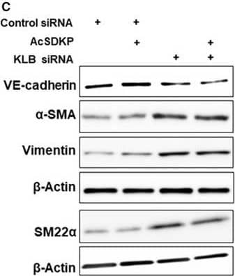 KLB deficiency led to EndMT in HMVECs. (A) Subconfluent HMVECs were transfected with KLB siRNA or control siRNA. Six hours later, the medium was replaced with an experimental medium, followed by N‐FGFR1 (1.5 mg·mL−1) treatment. At 48 h, the cells were harvested for western blot analysis. The results are from three repeated experiments. (B) The same treated HMVECs (as in A) cultured on 8‐well culture slides were subjected to immunofluorescence staining with an anti‐ alpha ‐SMA antibody and DAPI (scale bar, 100 μm). Six different fields were observed for each slide. (C) HMVECs with or without preincubation with AcSDKP (100 nm) for 2 h were transfected with KLB siRNA or control siRNA for 48 h. The expression of EndMT markers, including VE‐cadherin,  alpha ‐SMA, vimentin, and SM22 alpha , was assessed by western blotting and quantified (D) by imagej software (GE Healthcare Life Sciences, Uppsala, Sweden). The data represent mean +/- SD and are representative of three independent experiments. One‐way ANOVA with Tukey's multiple comparisons test was used for statistical analysis. Image collected and cropped by CiteAb from the following open publication (//pubmed.ncbi.nlm.nih.gov/30972974), licensed under a CC-BY license. Not internally tested by Novus Biologicals.