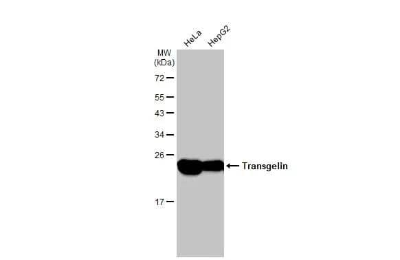 Western Blot Transgelin/TAGLN/SM22 alpha Antibody - BSA Free